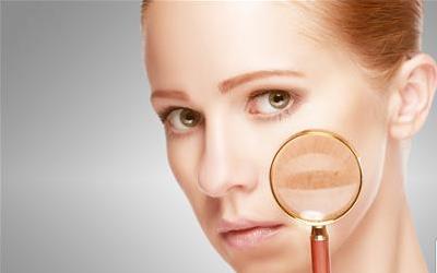 六种常见皮肤病，用牛奶就能轻松应对！