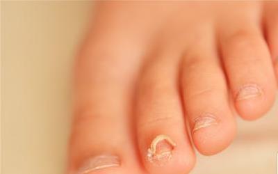 小孩指甲发白原因深度解析：年轻妈妈们必看的健康管理指南