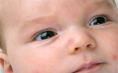 孩子后背起小疙瘩揭秘原因及应对策略