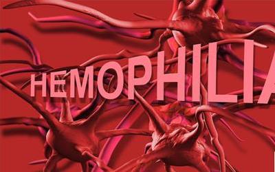 败血症：揭秘其成因、症状及预防方法