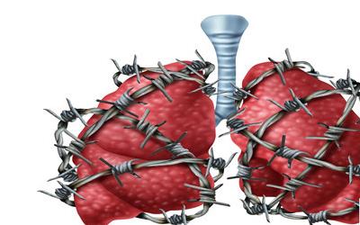 胸口下方中间疼痛的原因及应对方法