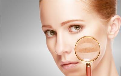 白殿疯的遗传风险与科学应对策略