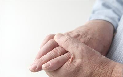 通过观察指甲判断健康状况：实用指南