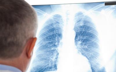 肺CT结果部分病灶钙化纤维化的详细解读与应对策略