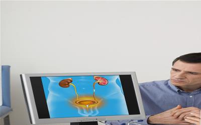 女性膀胱结石的典型症状与科学应对策略