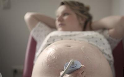 羊水先破：了解原因、应对措施及预防方法