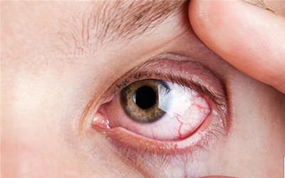 上眼睑长疙瘩：揭秘成因及有效去除方法