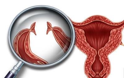 卵泡成熟度揭秘：成熟卵泡尺寸标准及影响