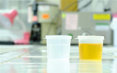 尿常规pH值8：揭秘偏碱性尿液与健康的关系