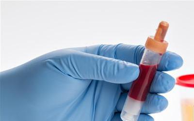 血清胰岛素偏高：揭秘背后的健康隐患及应对策略