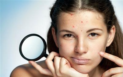 闭口粉刺的瘙痒成因及科学处理方法