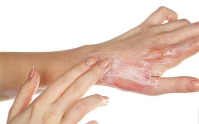 开水烫伤小水泡处理攻略：5种方法轻松应对