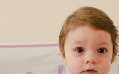 小孩风疹：揭秘病因，科学用药，全方位护理指南