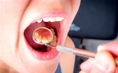 科学有效的方法，教你如何抬起软腭改善音质