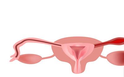 双侧输卵管远端梗阻：全面解析及治疗方法指南