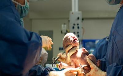 剖腹产后营养修复全攻略：科学饮食助你快速恢复