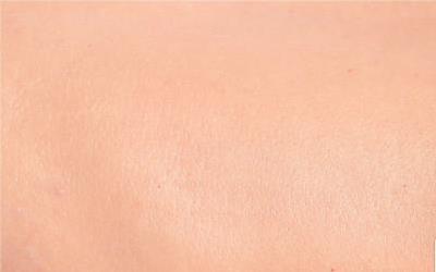 皮肤过敏患者能否安心享用甜玉米？专业指南解析