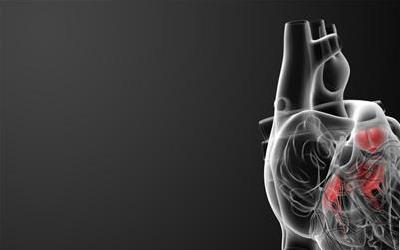 主动脉瓣回声增强的全面解读与应对策略