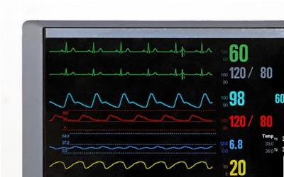 脉搏低于60的潜在风险及应对策略