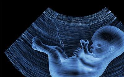 怀孕B超：最佳时间与重要性解析