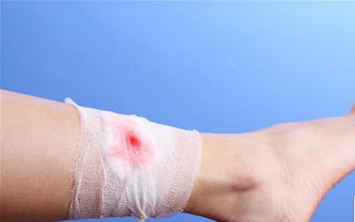 剖腹产后伤口化脓的深层原因与科学应对策略