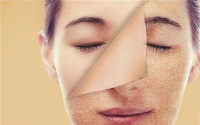 宝宝湿疹脱皮：揭秘症状及科学护理方法