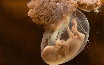 未见胎芽及胎心搏动的应对策略与治疗措施