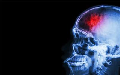 小儿脑炎：传染性及治疗方法全解析