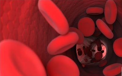 全面揭秘：五种有效增强血液循环的方法，让你远离血管疾病