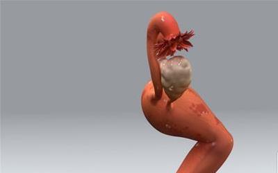 子宫内膜息肉术后全面保养指南：恢复健康的关键步骤