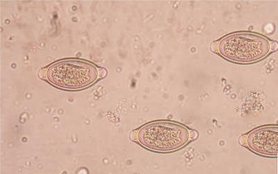 儿童手指白点：揭秘成因与科学应对方法
