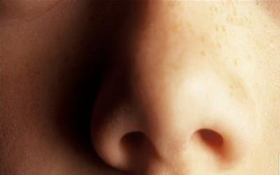 鼻粘膜糜烂：科学有效的治疗与护理方法