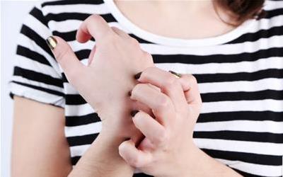 过敏性紫癫患者能否正常行走及注意事项