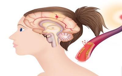 补脑汁：揭秘中药方剂的神奇功效，助你重拾记忆与活力