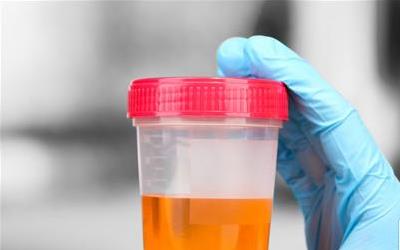 小便发红：警惕结石及其他潜在健康问题