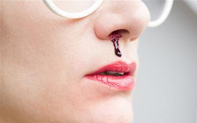 右侧鼻子出血揭秘：背后的原因及应对策略