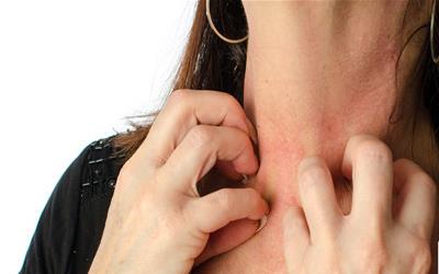 身上起热毒怎么办？中医食疗与生活调养全攻略