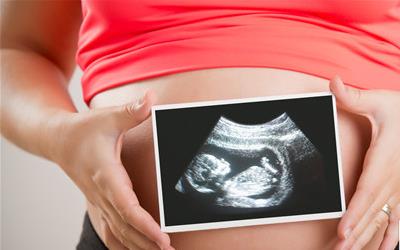 四个月胎动看男女：科学解析与实用指导