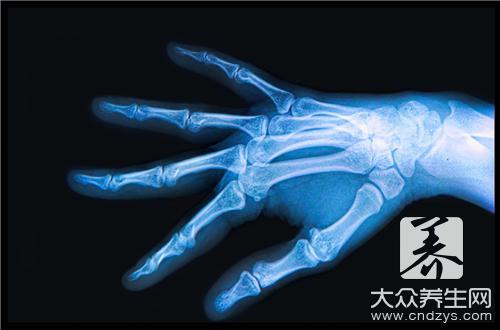 骨髓穿刺：了解禁忌症，守护健康防线